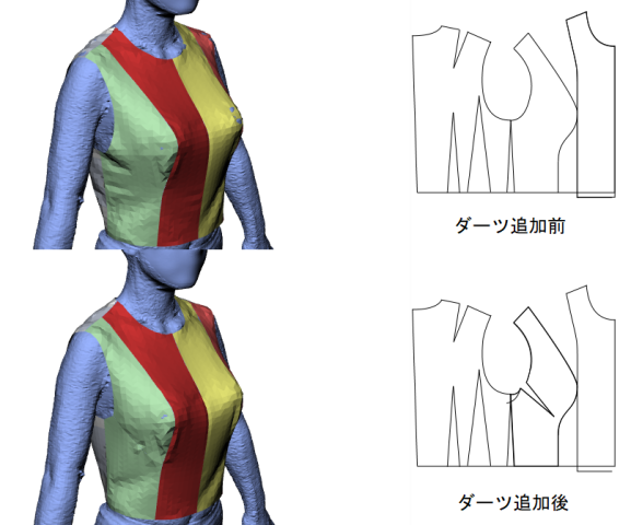 胸脇ダーツの追加前後
